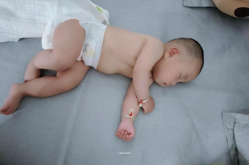 漳州六个月宝宝眼睛散光